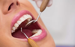 Estomatologia, doenças na Boca. Clínica Sorrio - DentistasRio.com.br
