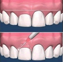 Gengivoplastia - Cirurgia Plástica Gengival -https://dentistasrio.com.br/site/anuncios/marcelo_lips-p2.php